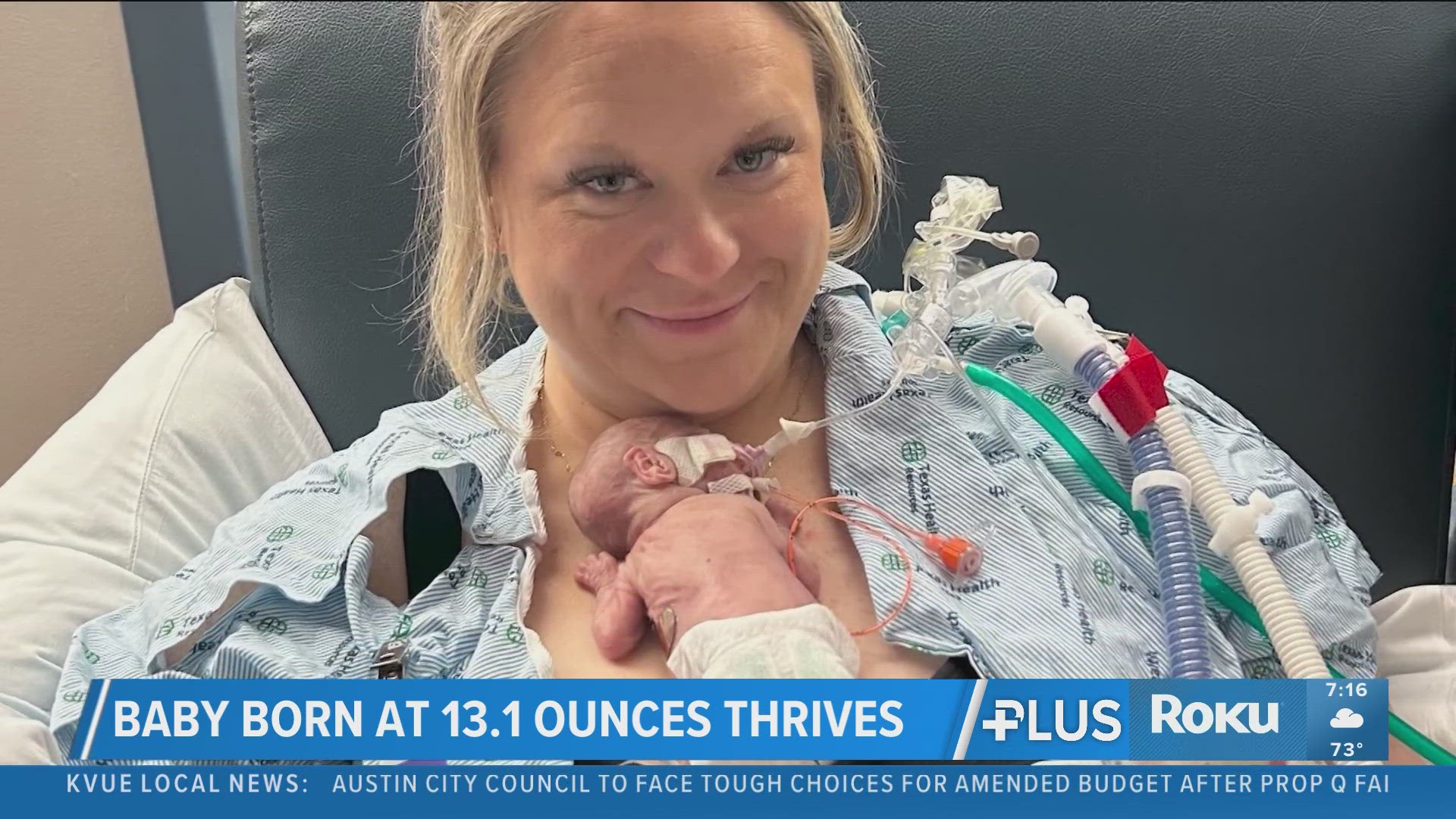 North Texas baby born weighing under 1 pound