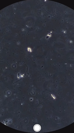 What’s Really Inside? A Shocking Microscopic Look at Poop