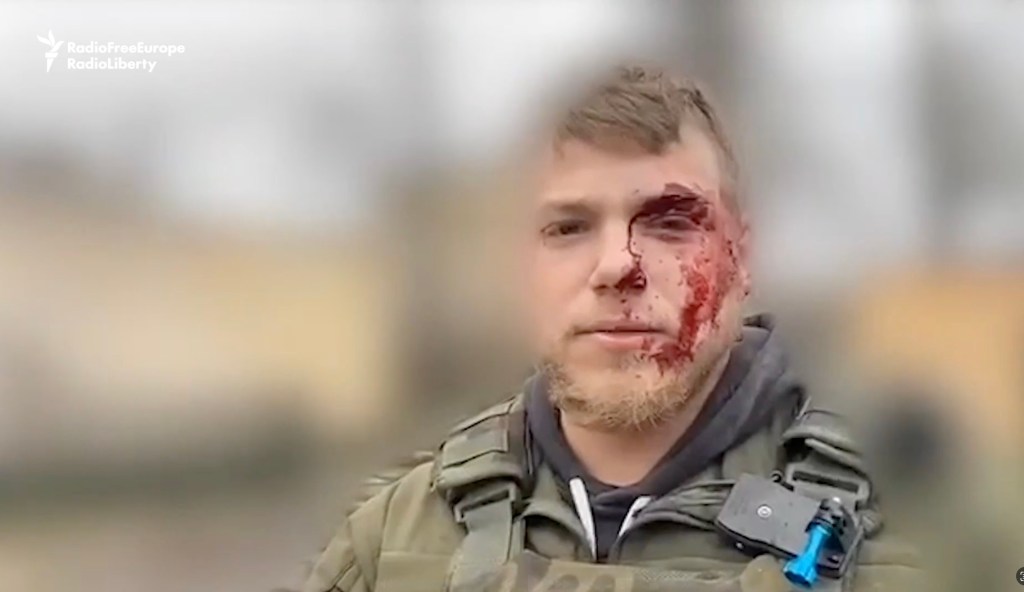 American volunteer injured by shrapnel from Russian drone strike in Ukraine