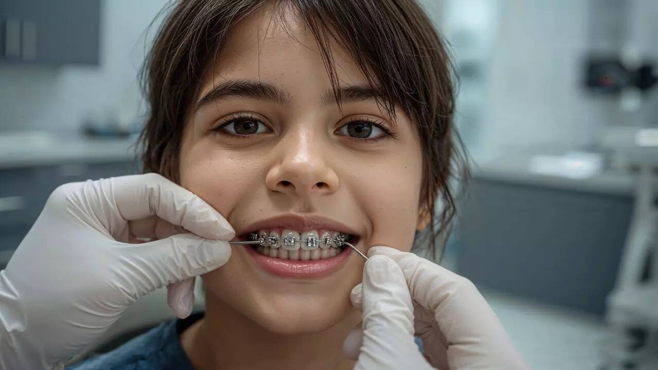 How to maintain oral hygiene with dental braces: Tips to prevent ...
