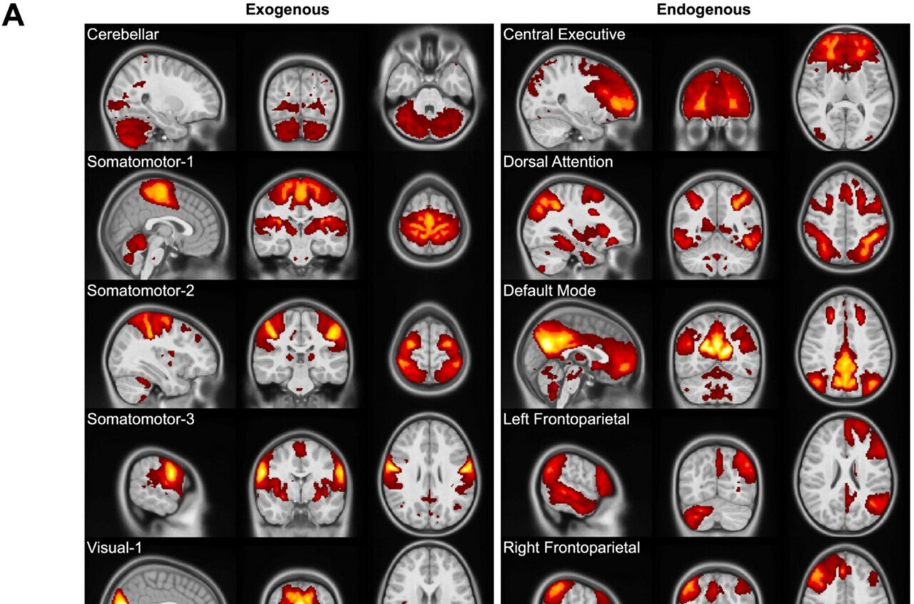 Some children's tantrums can be seen in the brain, new study reveals