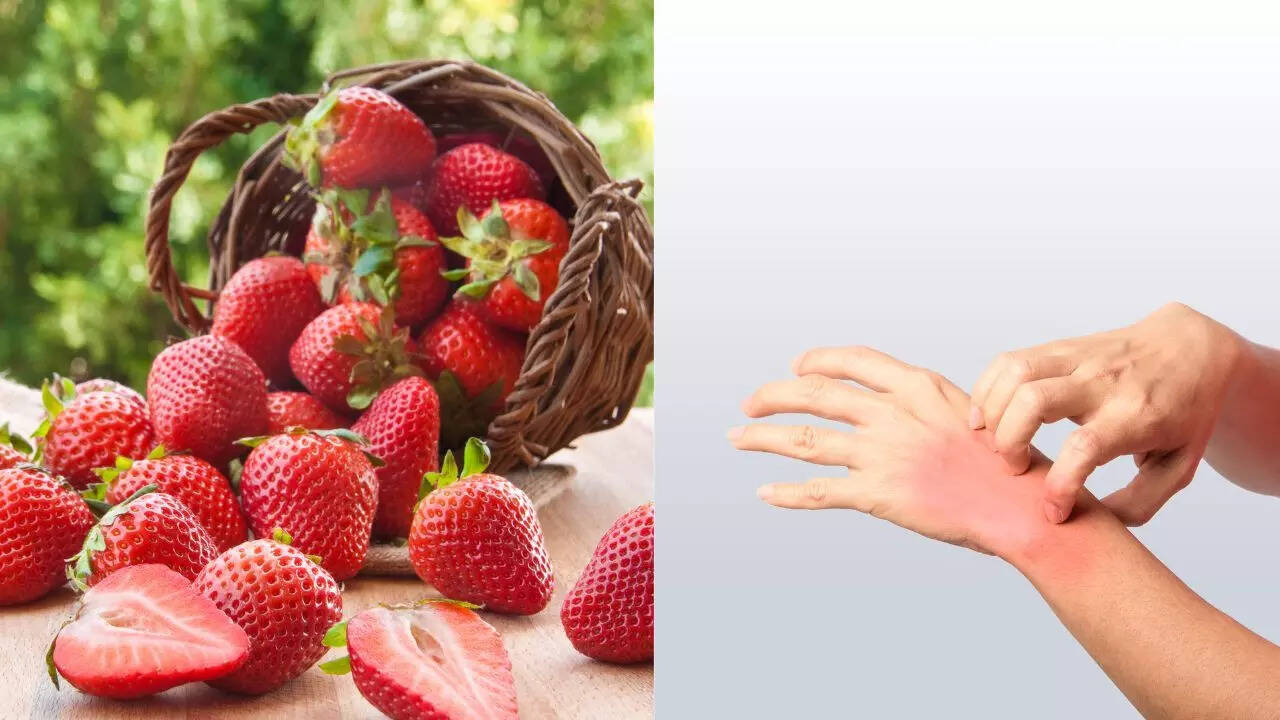 Can strawberries cause allergies: Know the signs, causes, and how to ...