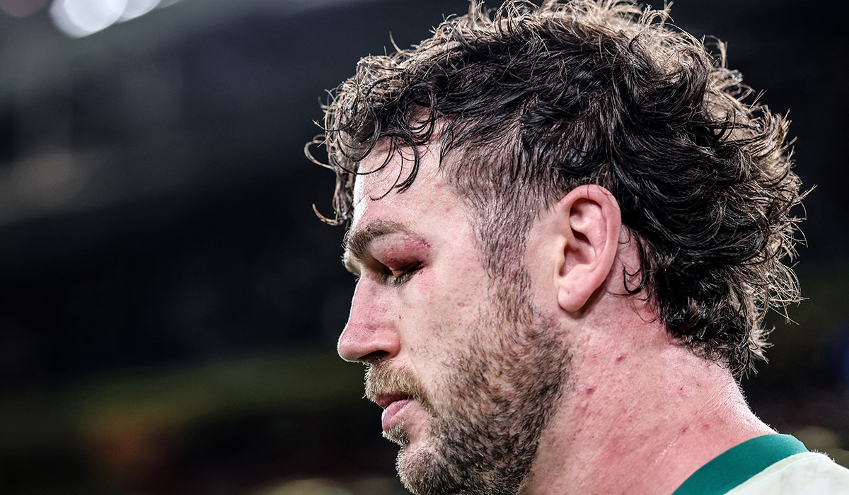 Andy Farrell backs his resiliant Ireland side after tough Springboks loss