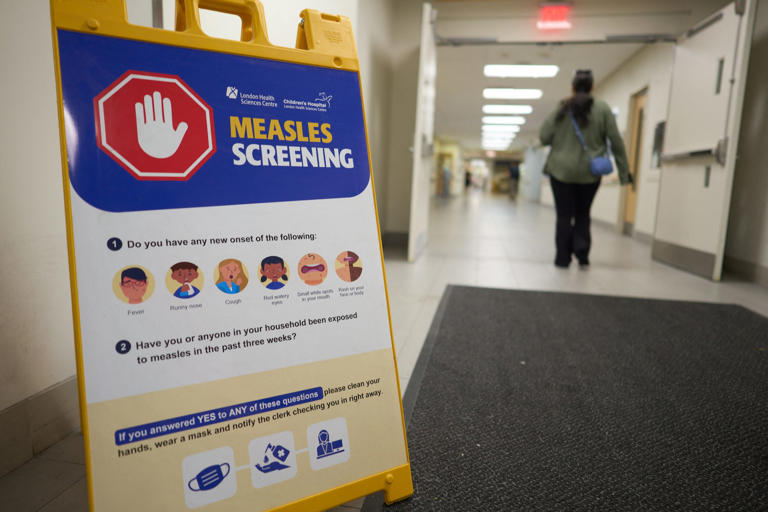 Canada no longer measles-free as health officials sound alarm
