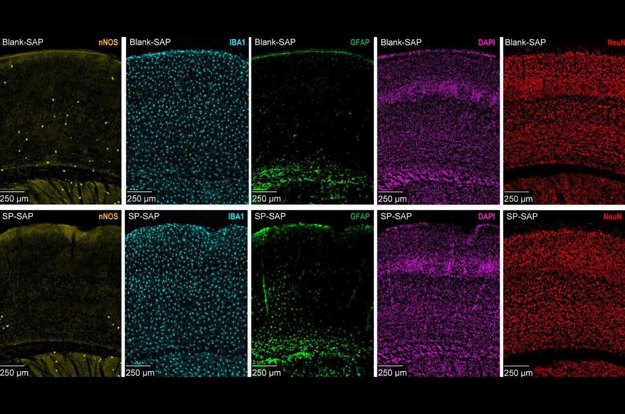 It's not just in your head: Stress may lead to altered blood flow in ...