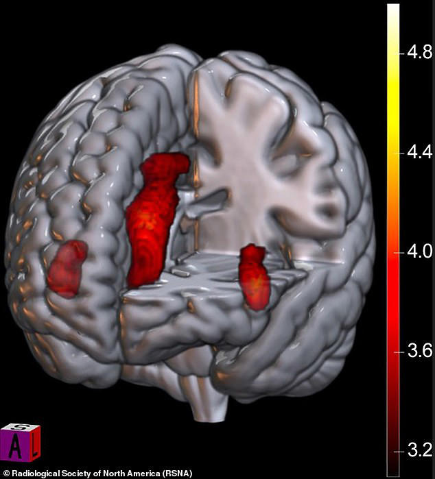 Scientists reveal exactly what happens in football fans' brains when ...
