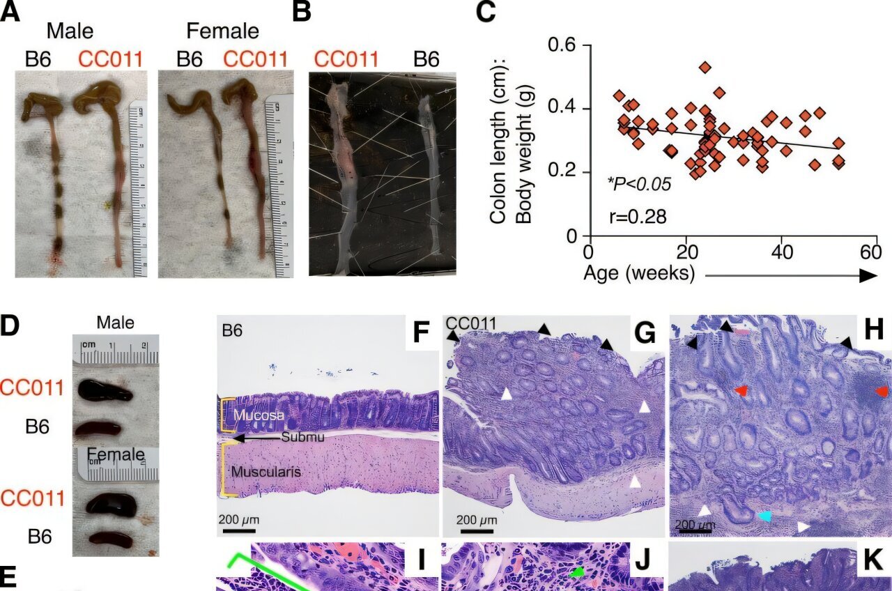 Q&A: Connection between a distinct immune cell and colitis discovered