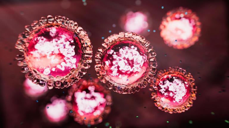 4 new cases of measles confirmed after outbreak linked to metro Atlanta ...