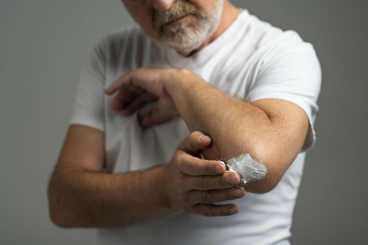 Apakah Pasta Gigi Bisa Sembuhkan Luka Bakar? Ini Fakta dan Cara Tepat