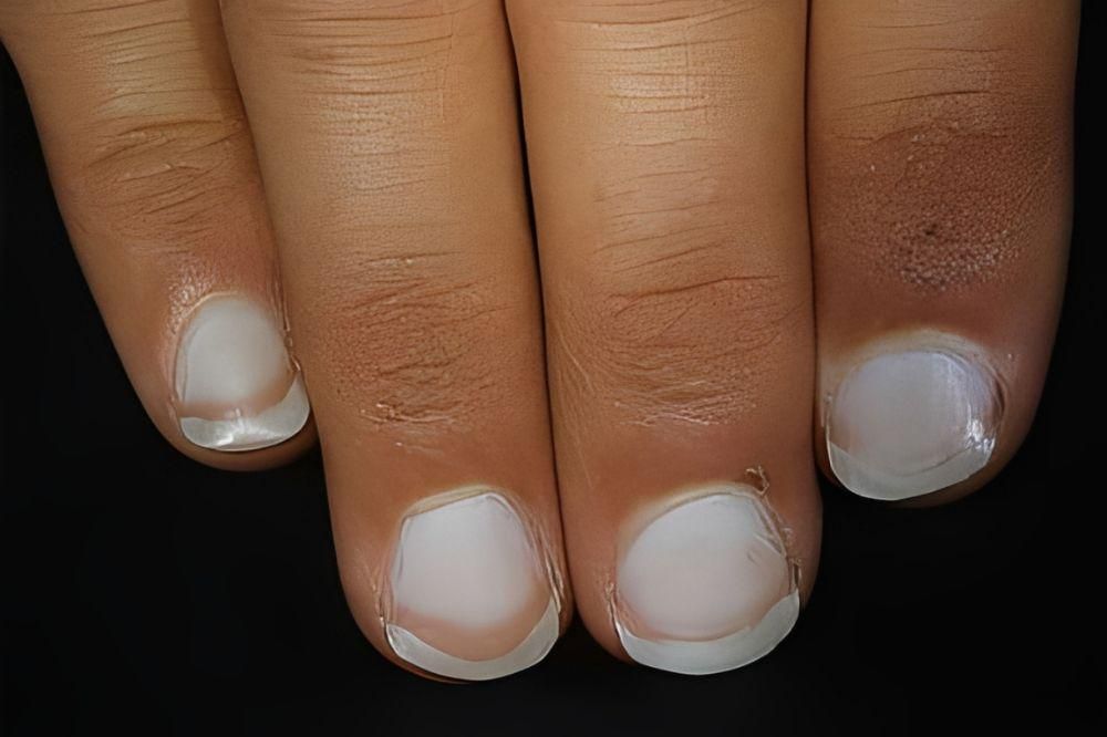 9 Tanda Kesehatan dari Warna Kuku, Cek Sekarang!