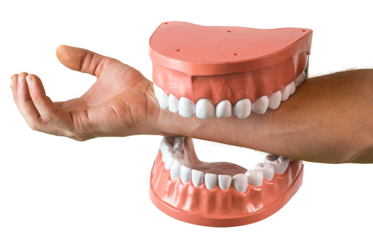 Bizarre Clauses in Pro Athlete Contracts