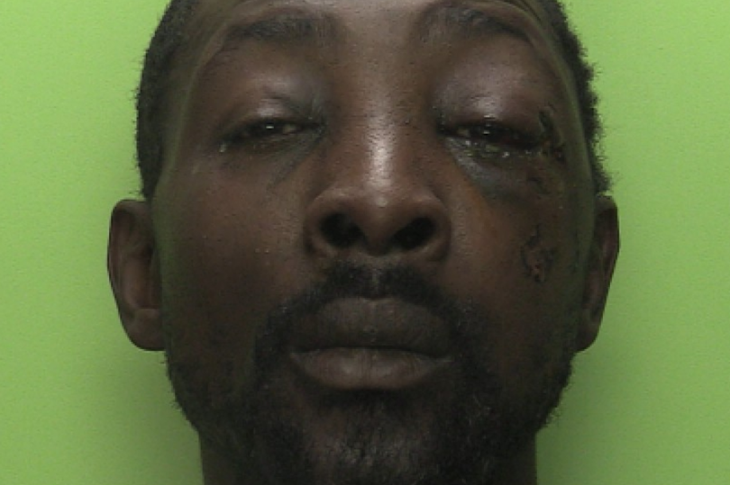 Savage city centre bottle attack leaves victim's life 'utterly devastated'