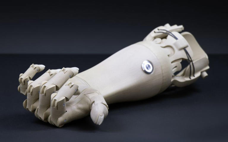 The Complicated Reality of 3D Printed Prosthetics