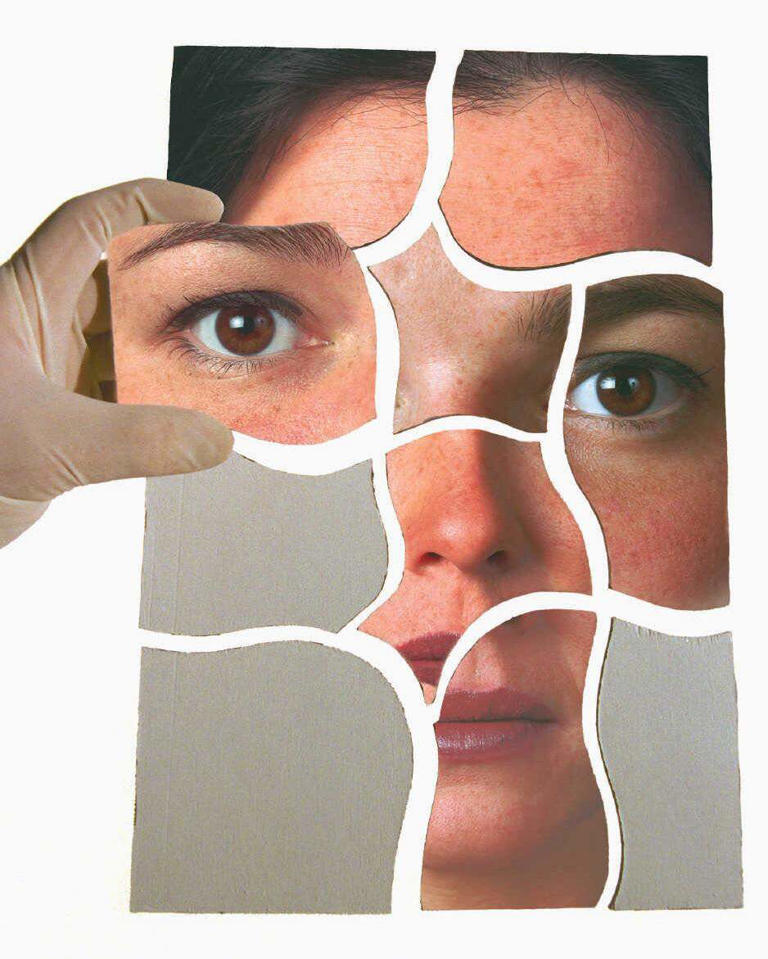 There's new tech for nose jobs - but nothing can replace the human touch