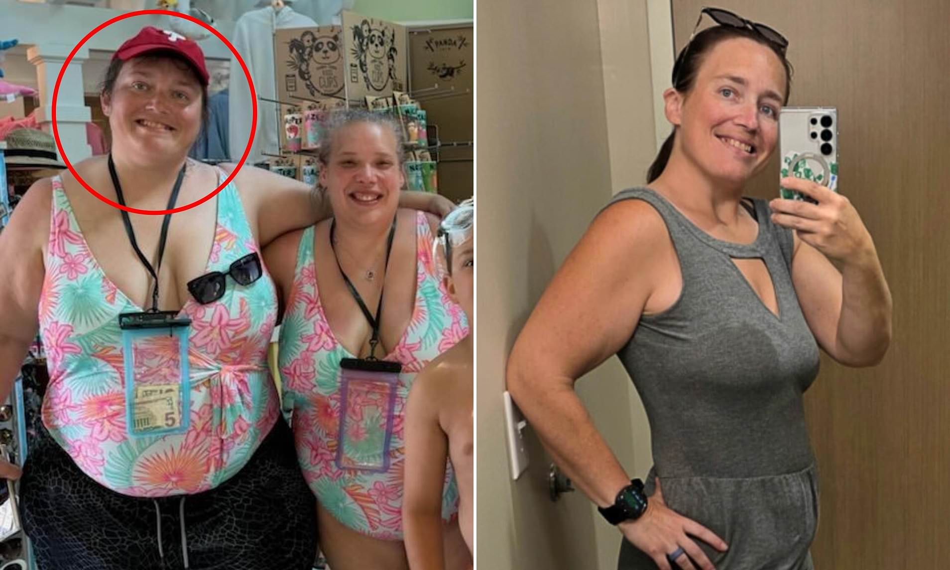 Doctors missed signs my weight loss surgery had gone horribly wrong ...