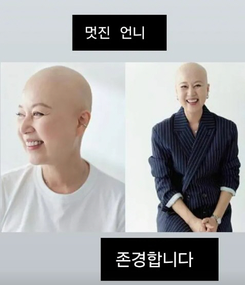 Cho Hye-ryeon, Park Mi-sun Applause for the courage of her bald head to ...