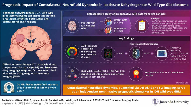 How brain fluid flow predicts survival in glioblastoma
