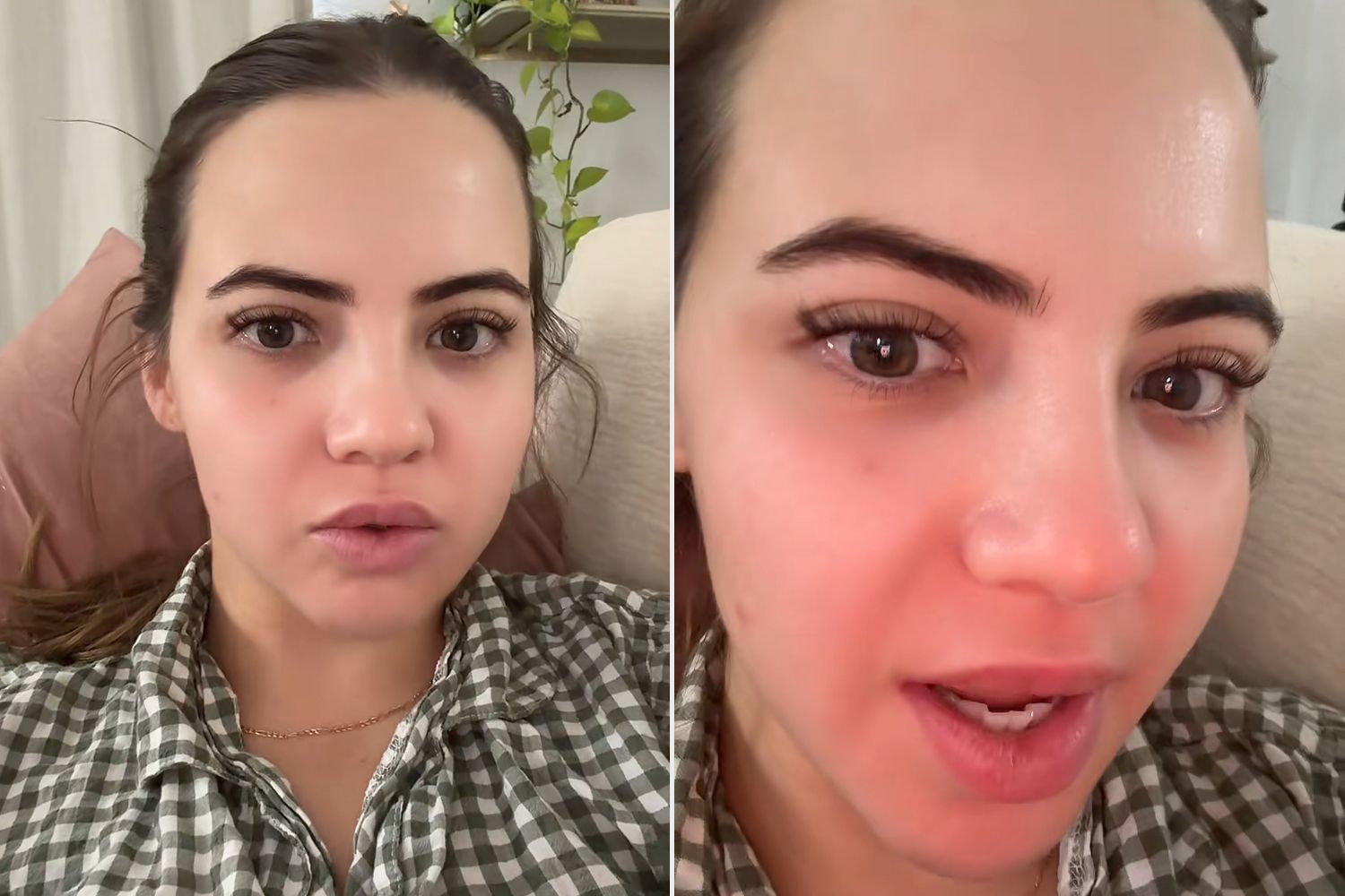 Bobbi Althoff Says Her Face Is 'Paralyzed' After Receiving 100 Units of