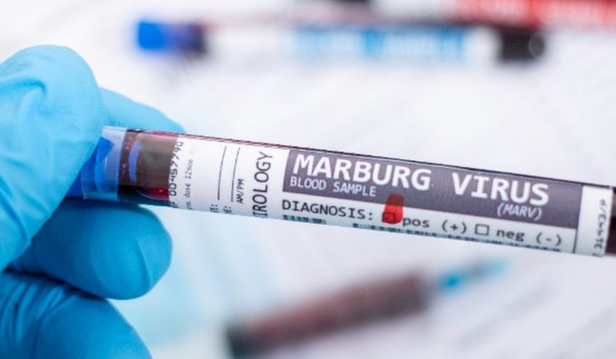 Etiopia, confermati nuovi casi del virus di Marburg