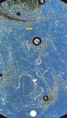 Tiny Fish Tank Worms Revealed Under the Microscope