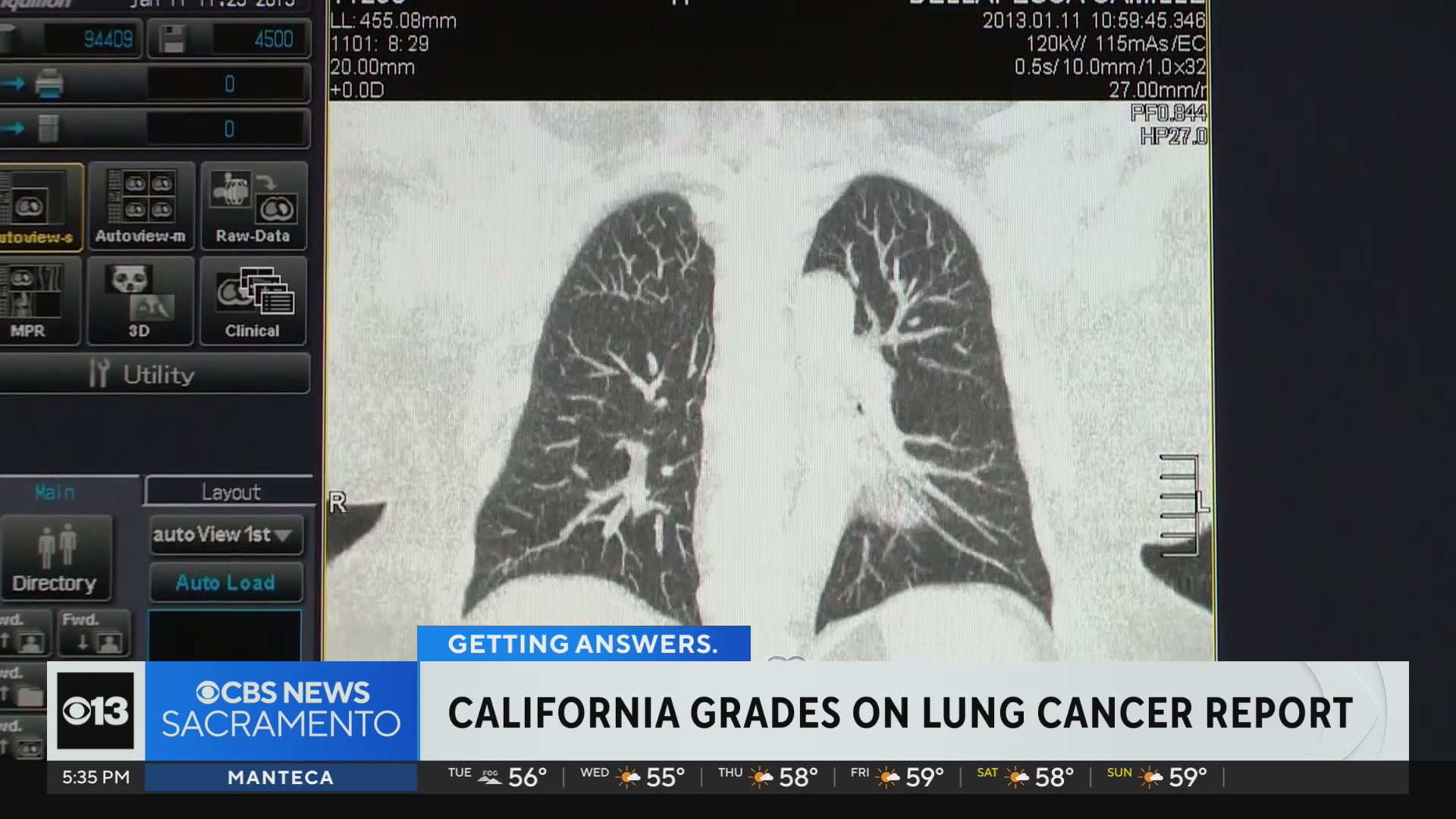 California ranks among best in nation in State of Lung Cancer report