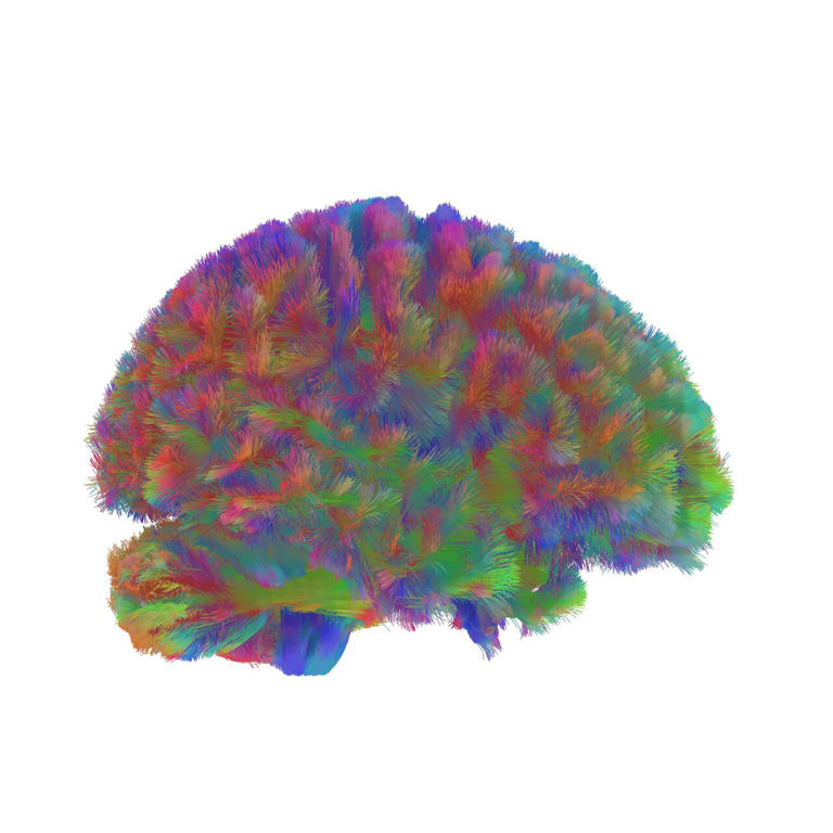 Scientists identify five structural eras of the human brain over a lifetime