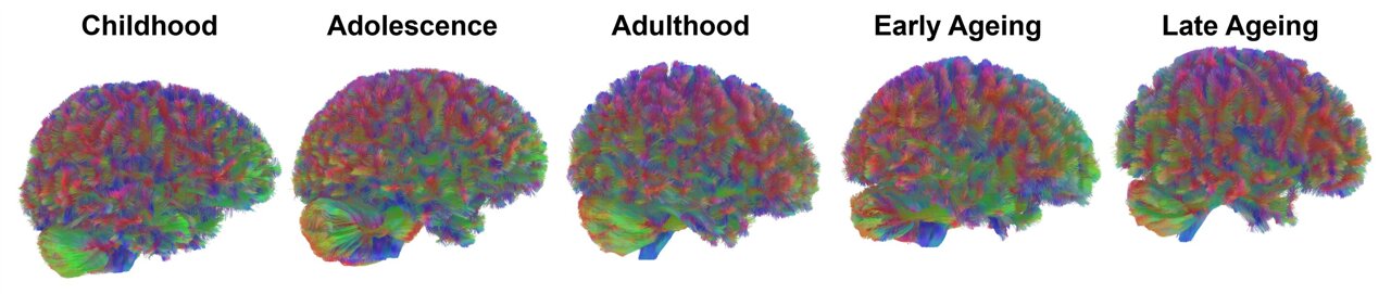 Scientists identify five structural eras of the human brain over a lifetime