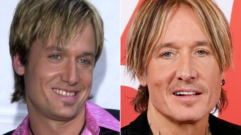 Side-By-Side Photos Of Keith Urban's Transformation Are Wild To See