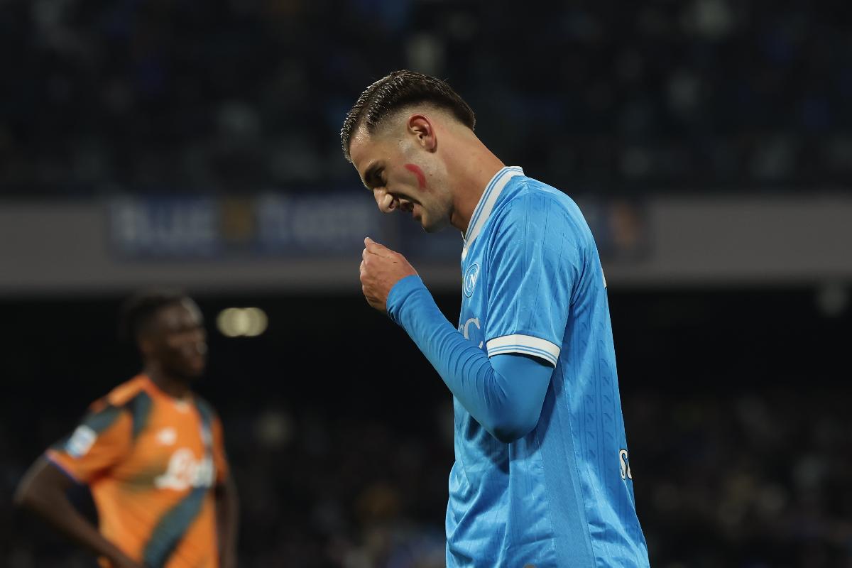 La Gazzetta dello Sport: "Napoli nei guai, Anguissa fuori almeno tre mesi&quot