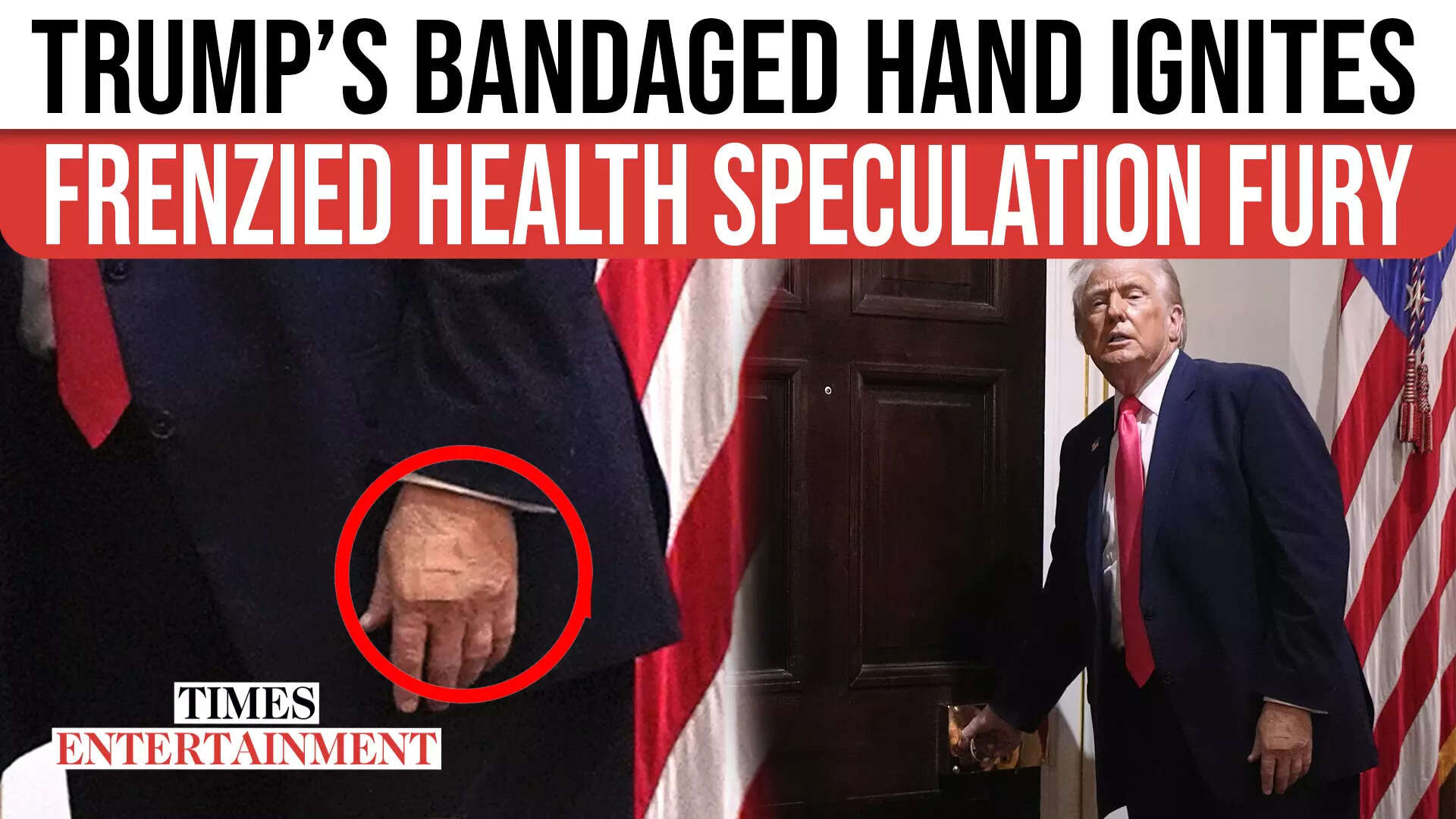 Trump Rages at Reporters After Bandaged Hand Goes Viral, Slams “Crazy ...