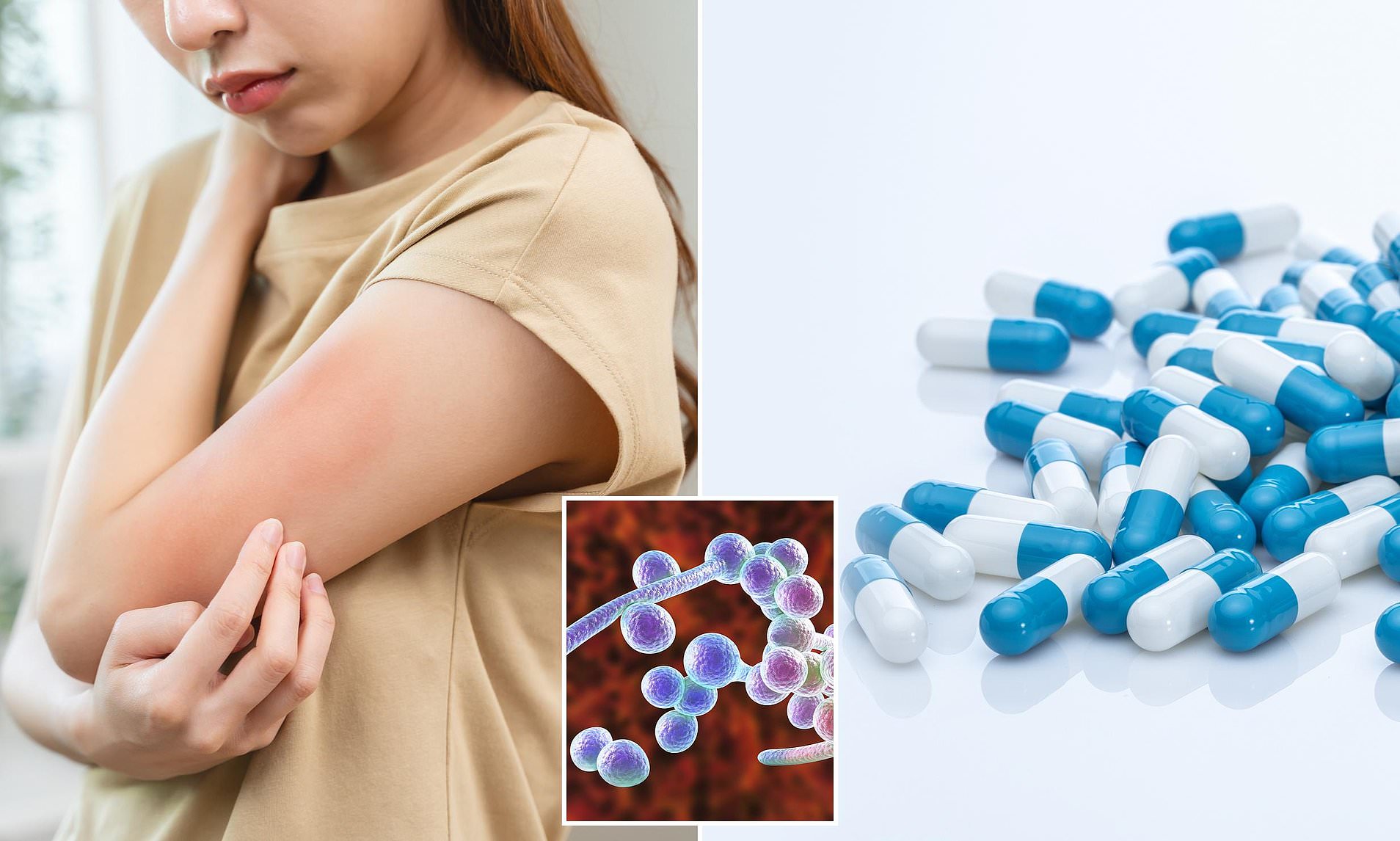 Common bacteria are 'adapting' to become resistant to drugs... posing ...