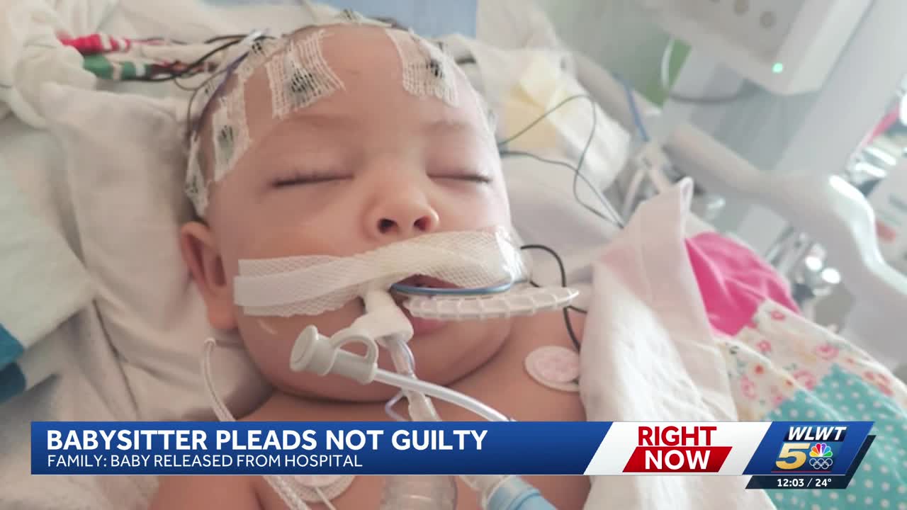 Baby returns home after weeks in hospital with serious injuries ...