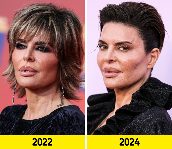 Her lips are bigger than ever, Lisa Rinna’s latest appearance sparks ...