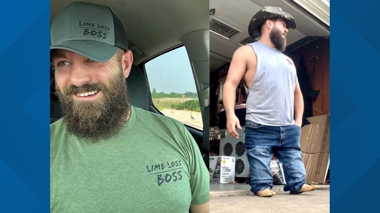 Illinois man known as 'Limb Loss Boss' turns trauma into social media ...