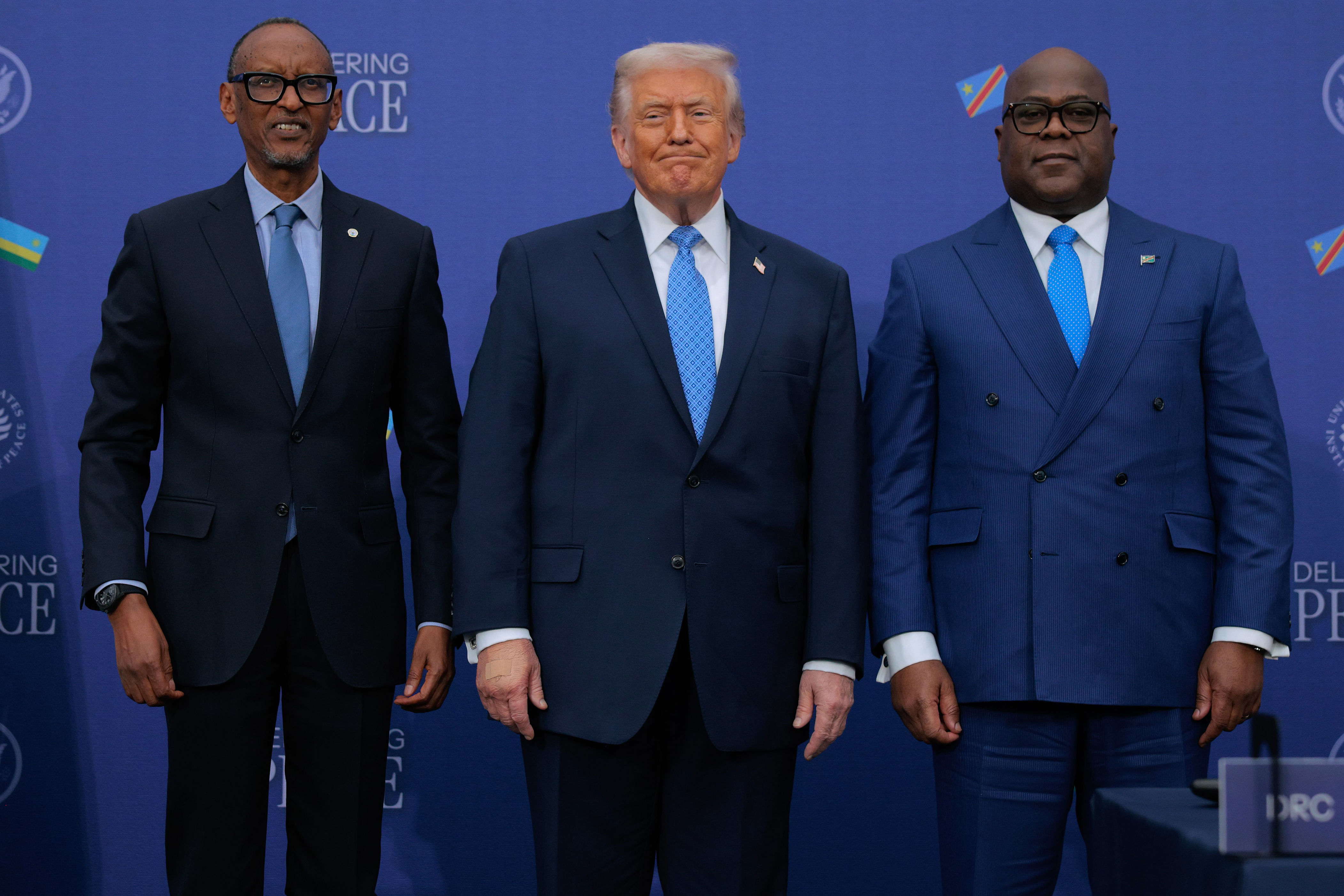 Fresh pic shows Donald Trump’s troubled hand is not getting better