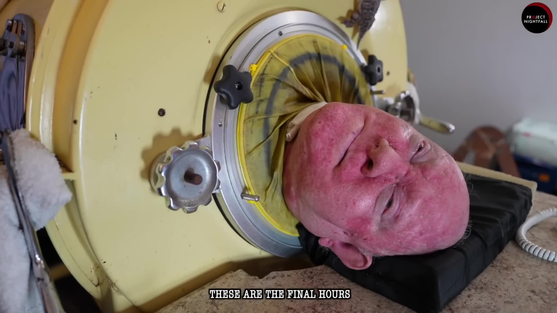 Polio survivor spent entire life inside iron lung machine