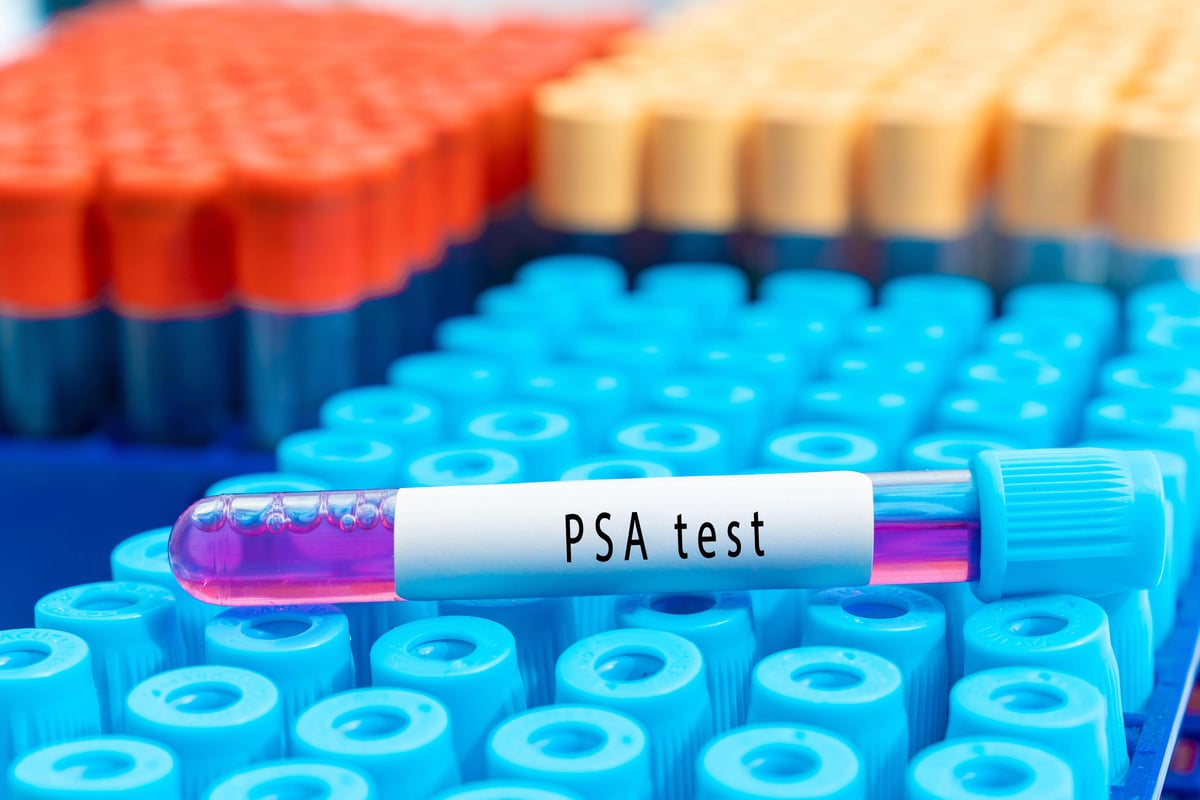 Trial for prostate cancer treatment with fewer side-effects launches in UK