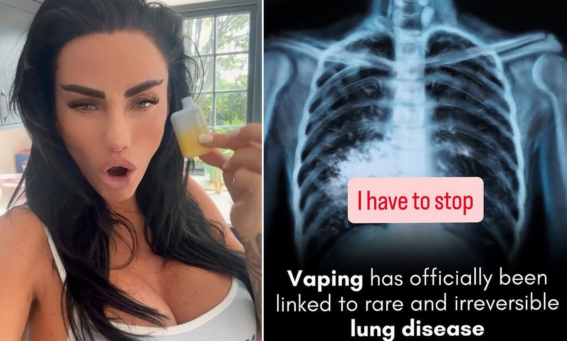 Katie Price's 'family is very worried' about her vaping addiction as she  shares alarming X-ray
