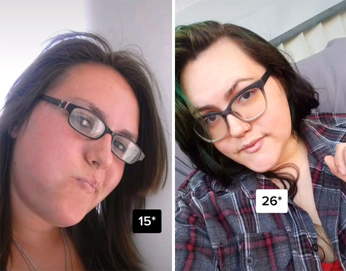 23 people share how they somehow managed to reverse age like Benjamin ...