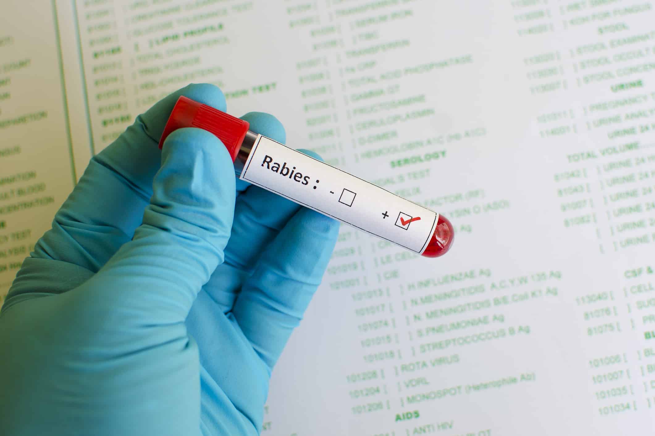 These two states are the epicenter for rabies cases in the US