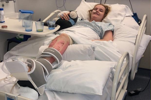 Woman who lost leg in 'devastating' tractor crash helps NHS blood appeal