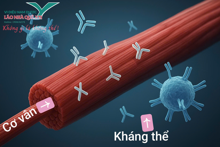 Kháng thể tự miễn tiêu cơ vân hướng phục hồi từ trị liệu khai thông cột sống