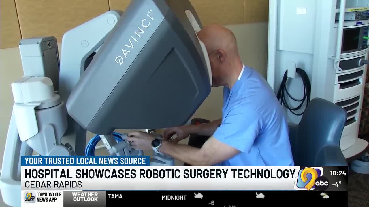 Unity Point Health Saint Luke’s Hospital highlights 20 years of robotic ...