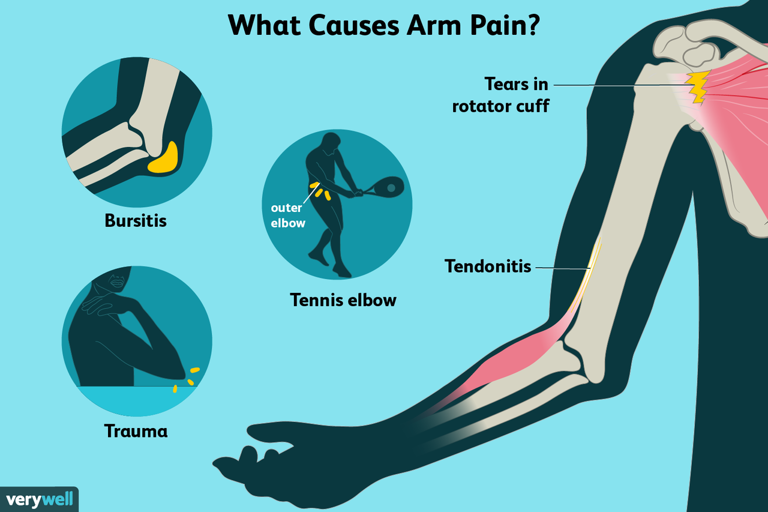 Why does my arm hurt? Possible causes and how to manage them