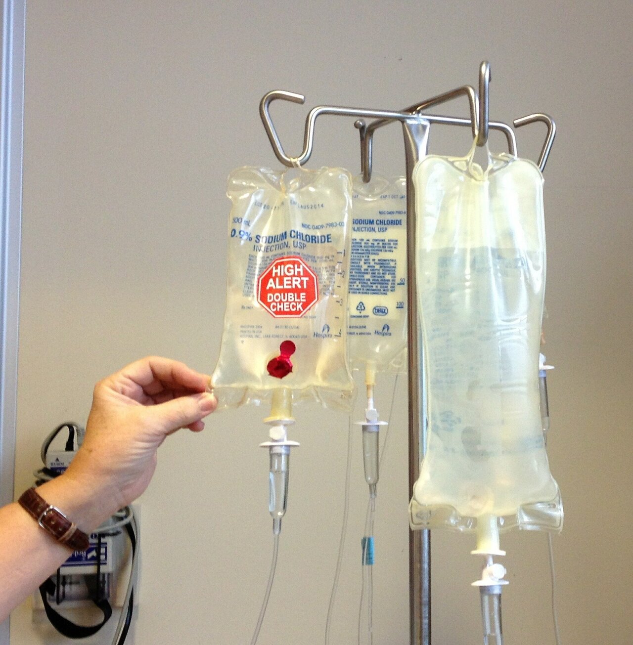 Milder chemotherapy proves effective for rare, aggressive lymphoma