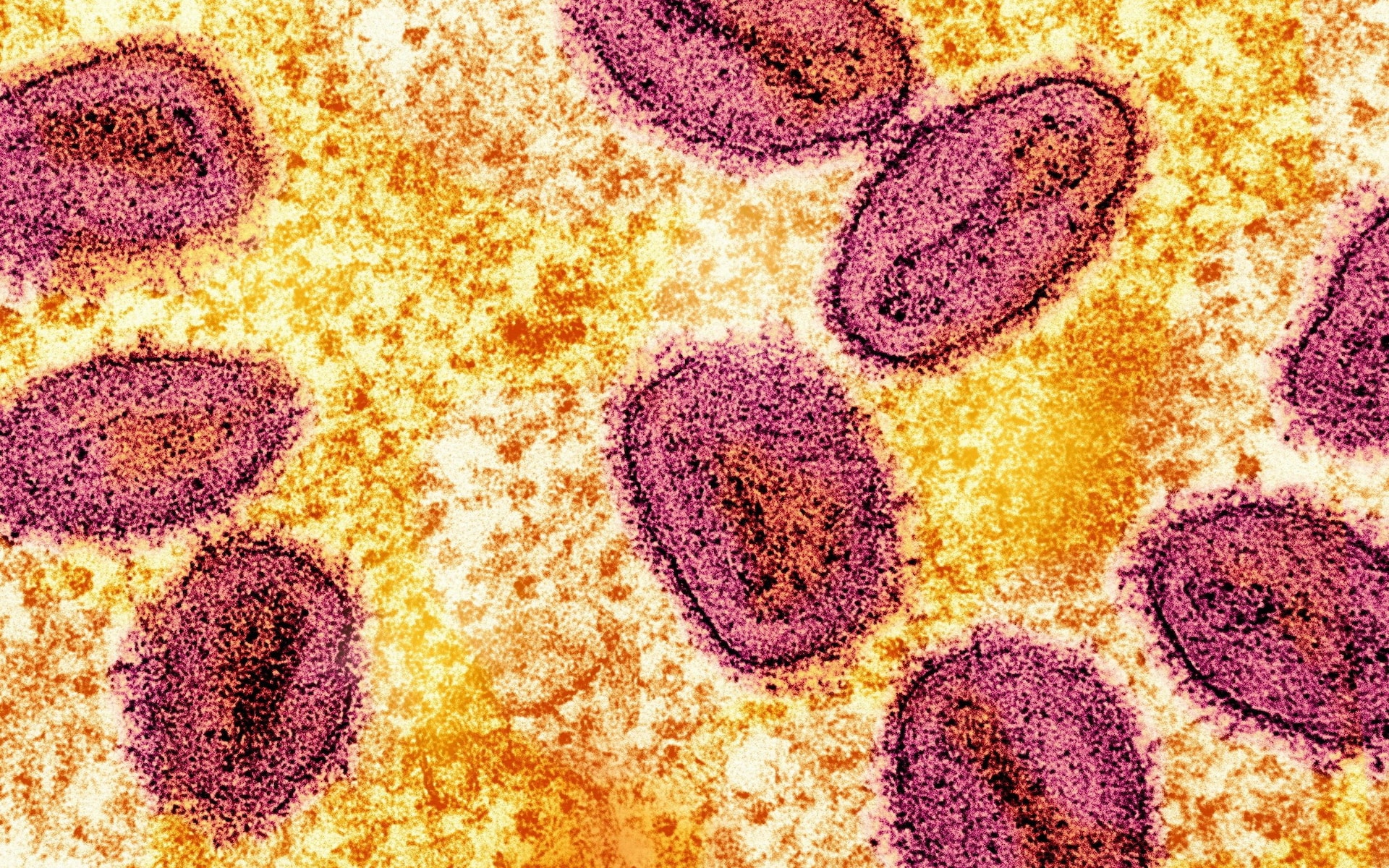 New hybrid MPOX strain identified in England
