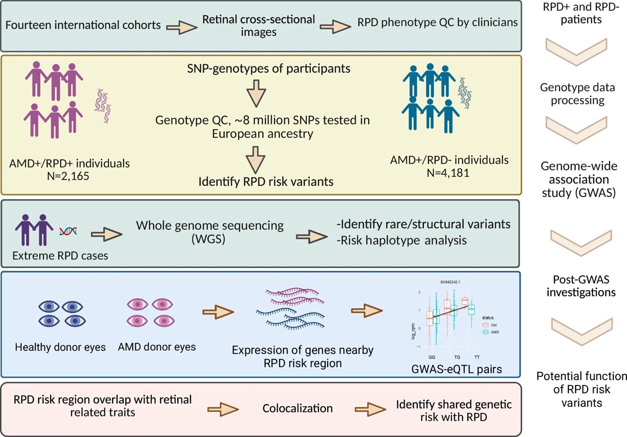 Scientists reveal new genetic risk for severe macular degeneration