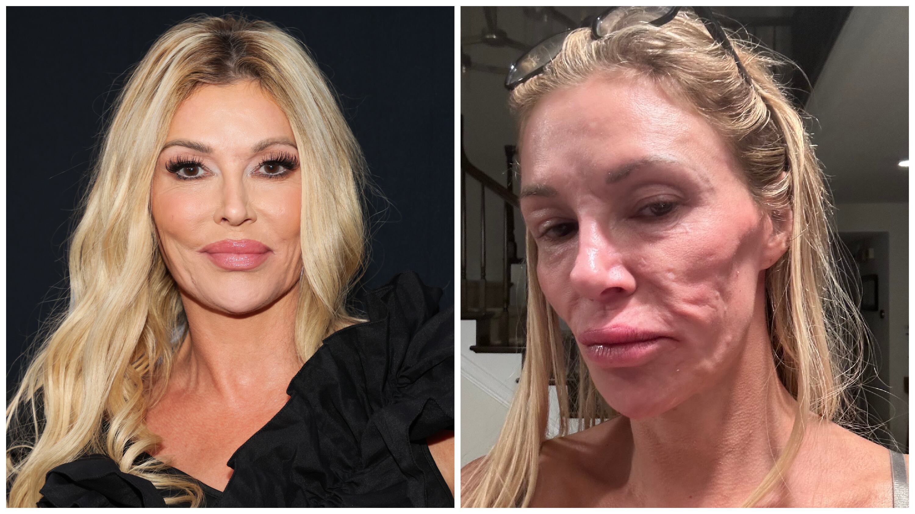 Real housewife finally receives diagnosis for mystery facial disfigurement