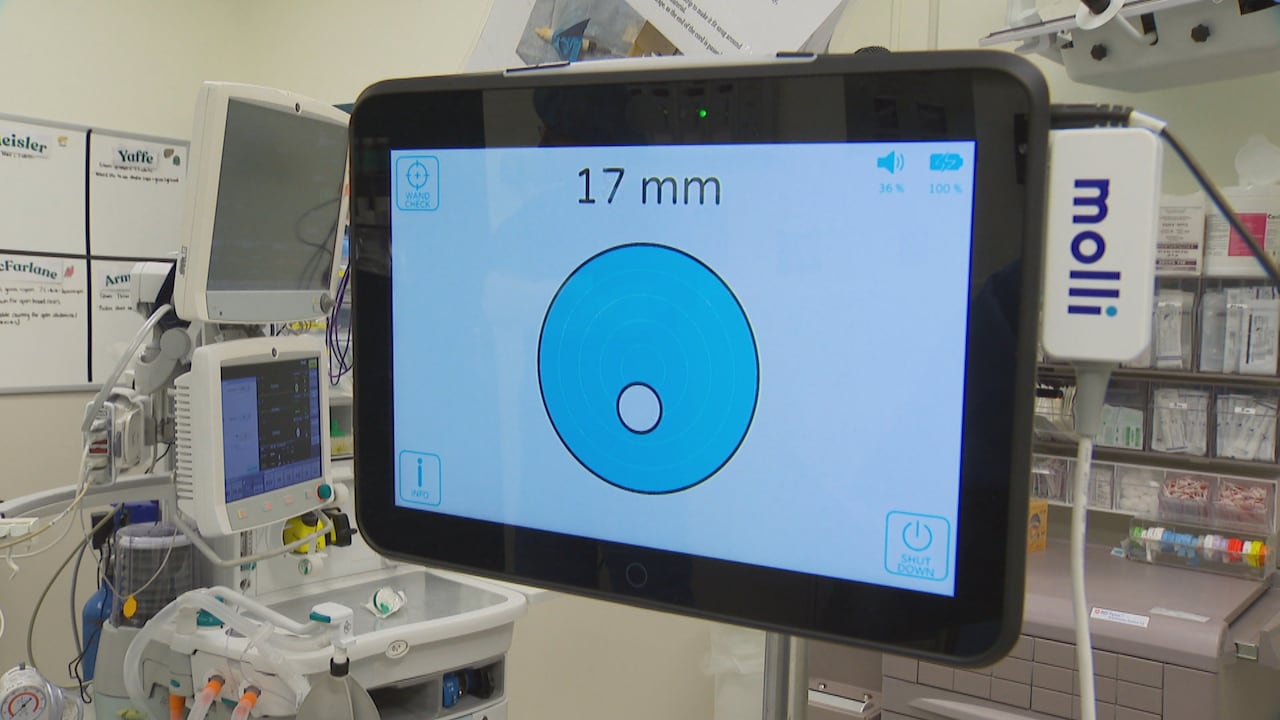 Tiny device helps provide better cancer care to NS patients