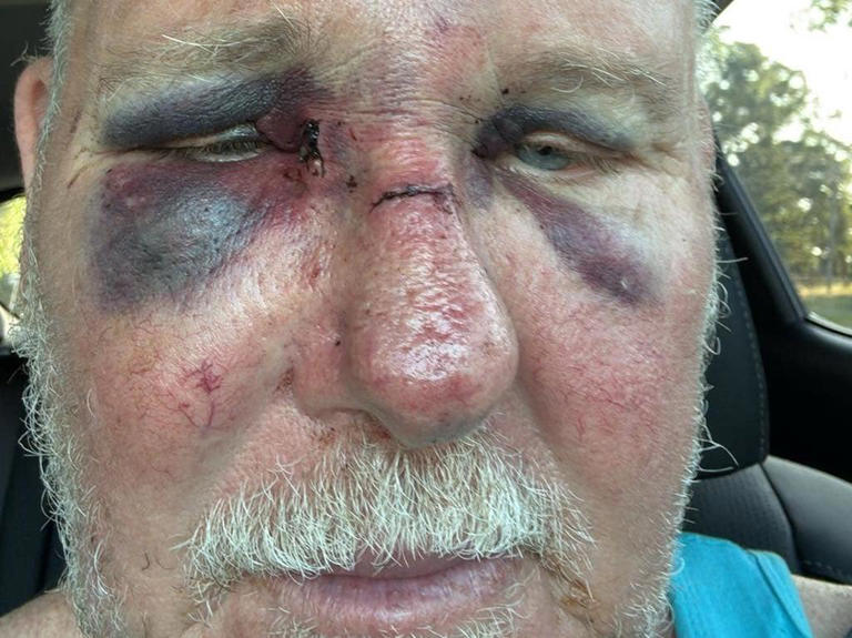 Big call on inmate who bashed officers